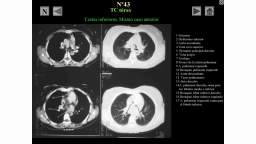 Extraresumen de la radiología