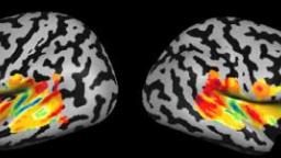 cochleotopic mapping of human auditory cortical fields